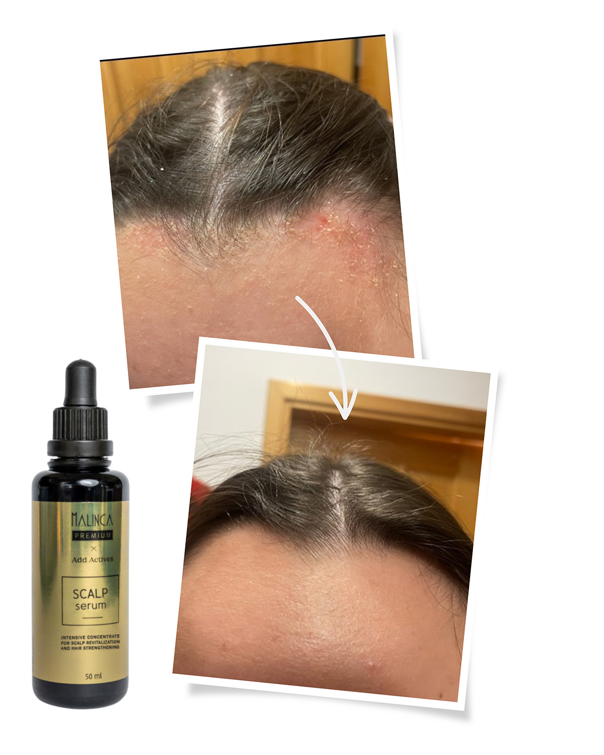 Serum für die Kopfhaut