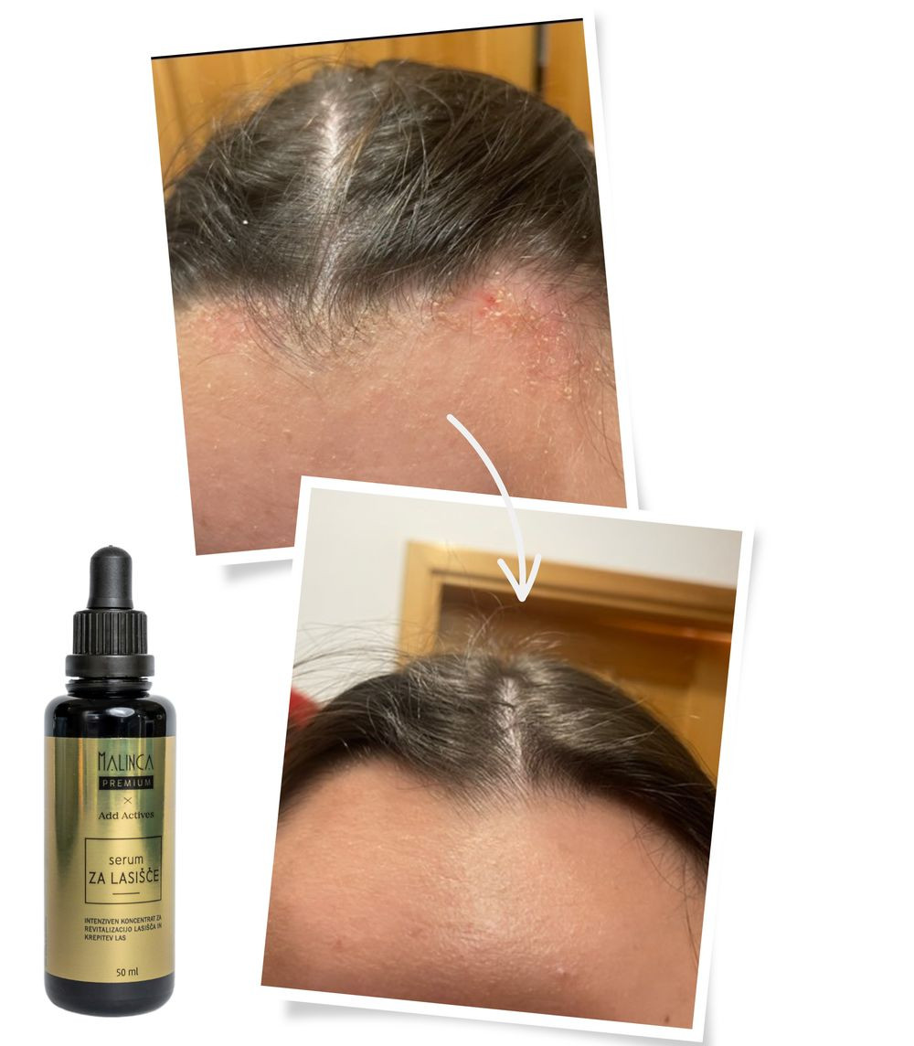 Serum für die Kopfhaut