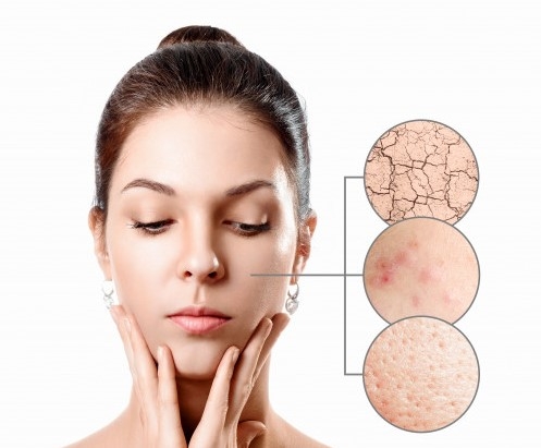 Posledice izgube ceramidov